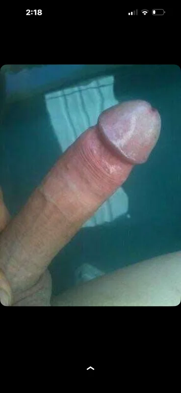 TSSTAR⭐️💫 - Escort in Melbourne, VIC, photo 4